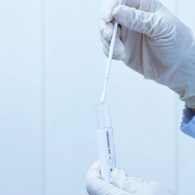 Fine Chemicals Diagnostics PCR test