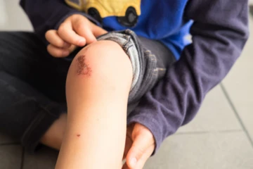 Wound on kids knee